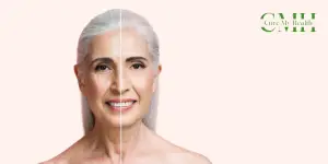 Skin ageing