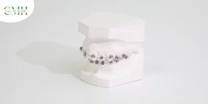 What is Leprosy? 6 ASSISTIVE DEVICES