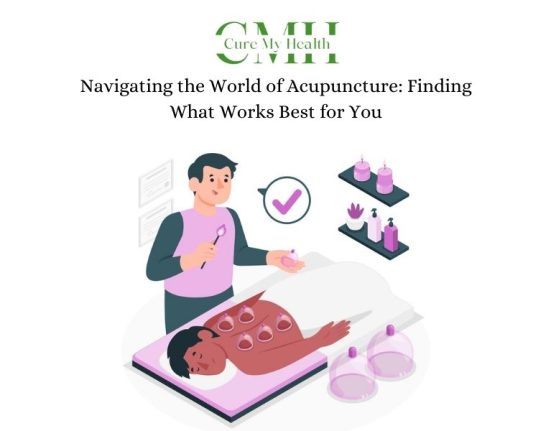 Navigating the World of Acupuncture