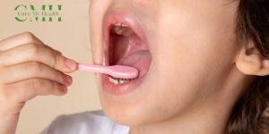 What are Mouth Ulcers?